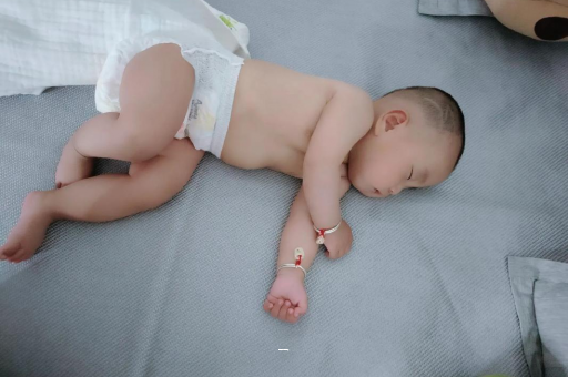 双鸭山宝宝脸上有白色斑块